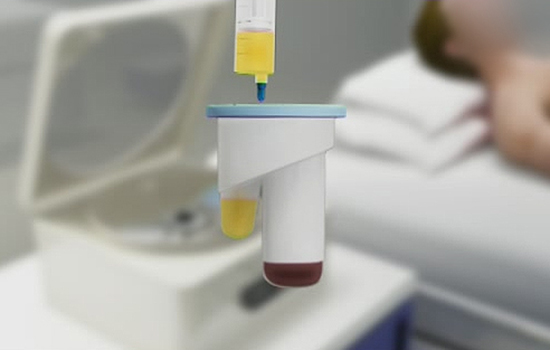 What Is PRP Therapy?