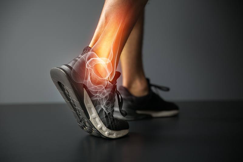 The “All-Inside” Arthroscopic Brostrom Procedure in Palm Beach County