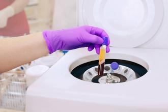 Platelet Rich Plasma (PRP) and Stem Cells: What’s the Difference?