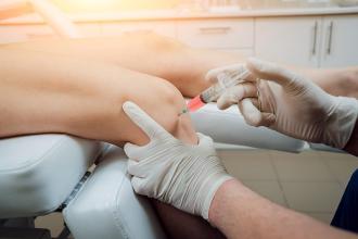 Is PRP Right for Me?