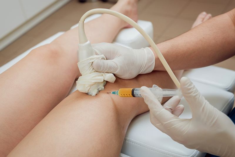Stem Cell Therapy Following Meniscus Knee Surgery May Reduce Pain, Restore Meniscus