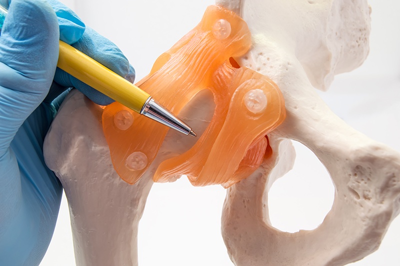 Anterior Hip Replacement: What You Need to Know