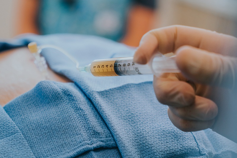 The Benefits of PRP Therapy