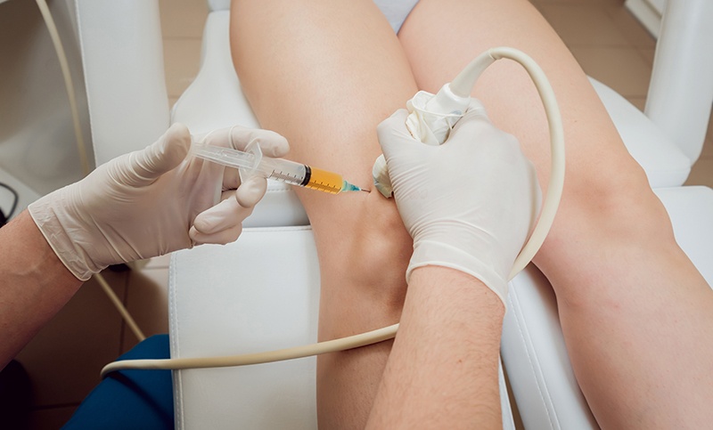 What is PRP Therapy and How Does it Work?