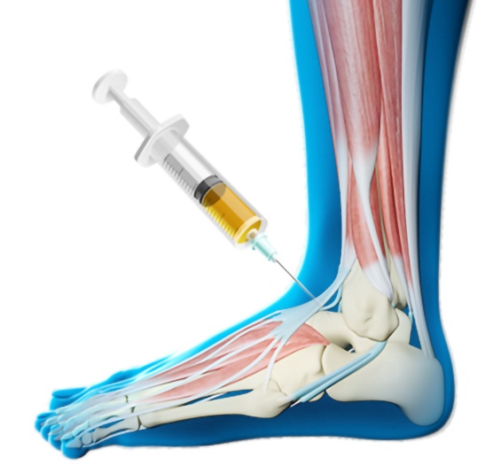 What is PRP Therapy and Does it Get Results?