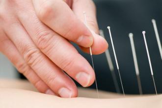 Acupuncture: Does It Work?