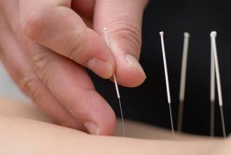 A Look at Medical Acupuncture